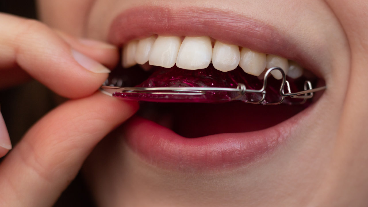 A young woman putting on her retainer in Warrington, PA
